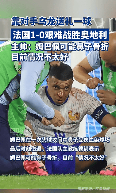 【168sports】全世界都在关心姆巴佩的鼻子